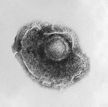 A viral envelope.