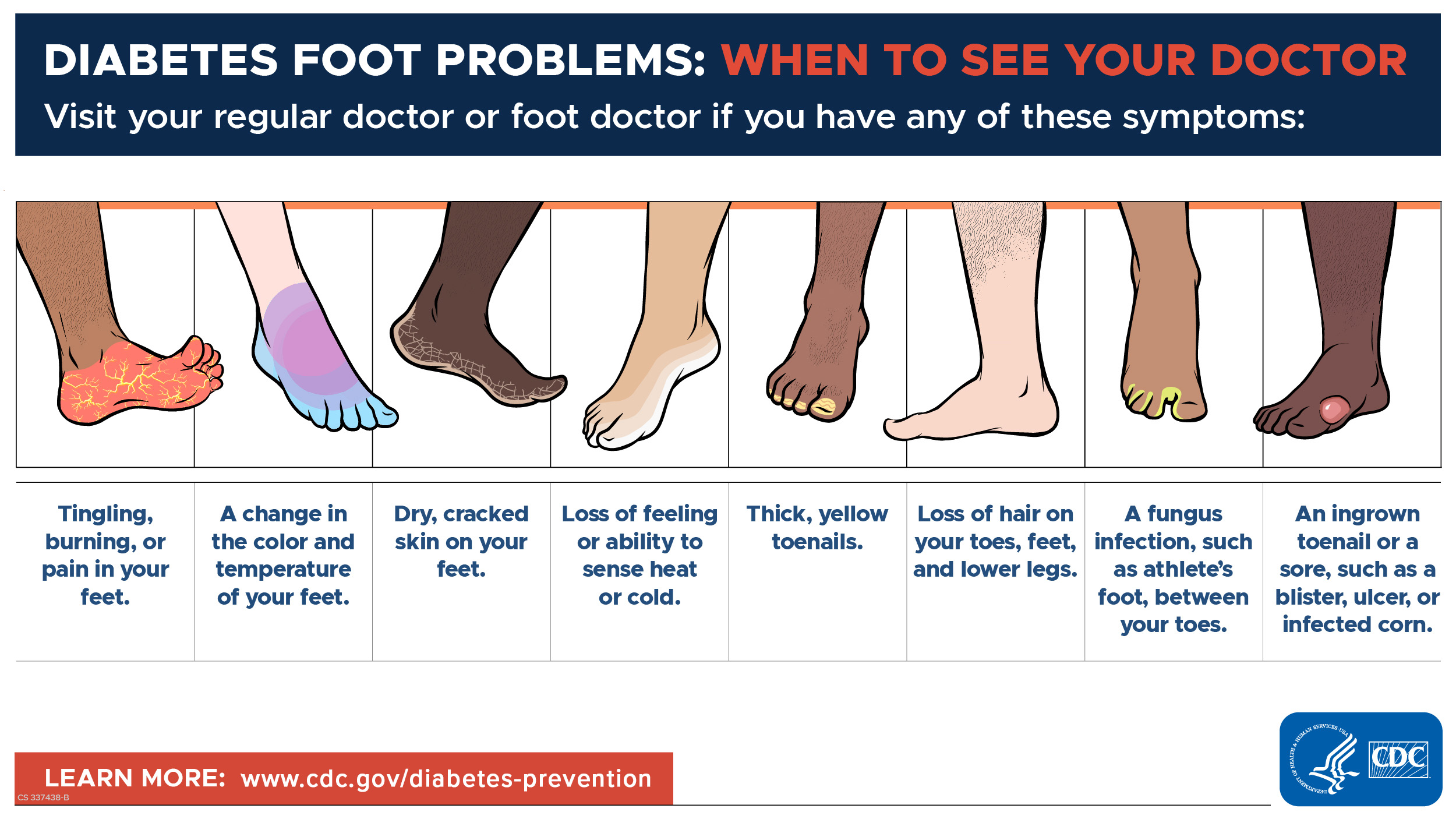 CDC chart of diabetes foot problems that mean you should see your doctor