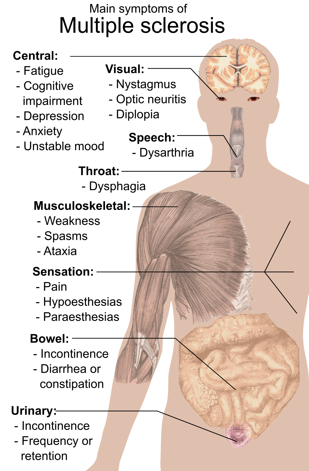 Figure 1.0 Symptoms of MS