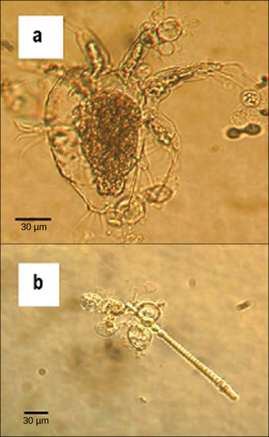 Micrograph A shows an arthropod, which is a teardrop-shaped transparent organism about 90 microns across and 120 microns long. Tentacle-like appendages jut out from the front, wide end of the organism, and clusters of cilia-like appendages just out from either side and the back. Transparent oval organisms about 20 microns across cling to the arthropod. Micrograph B shows a similar oval transparent organisms clinging to rod-shaped algae about 5 microns across and 200 microns long.