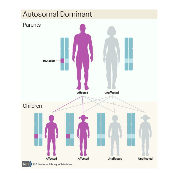 A parent with an autosomal dominant condition passes the altered gene to two affected children. Two other children do not receive the altered gene, and are unaffected.