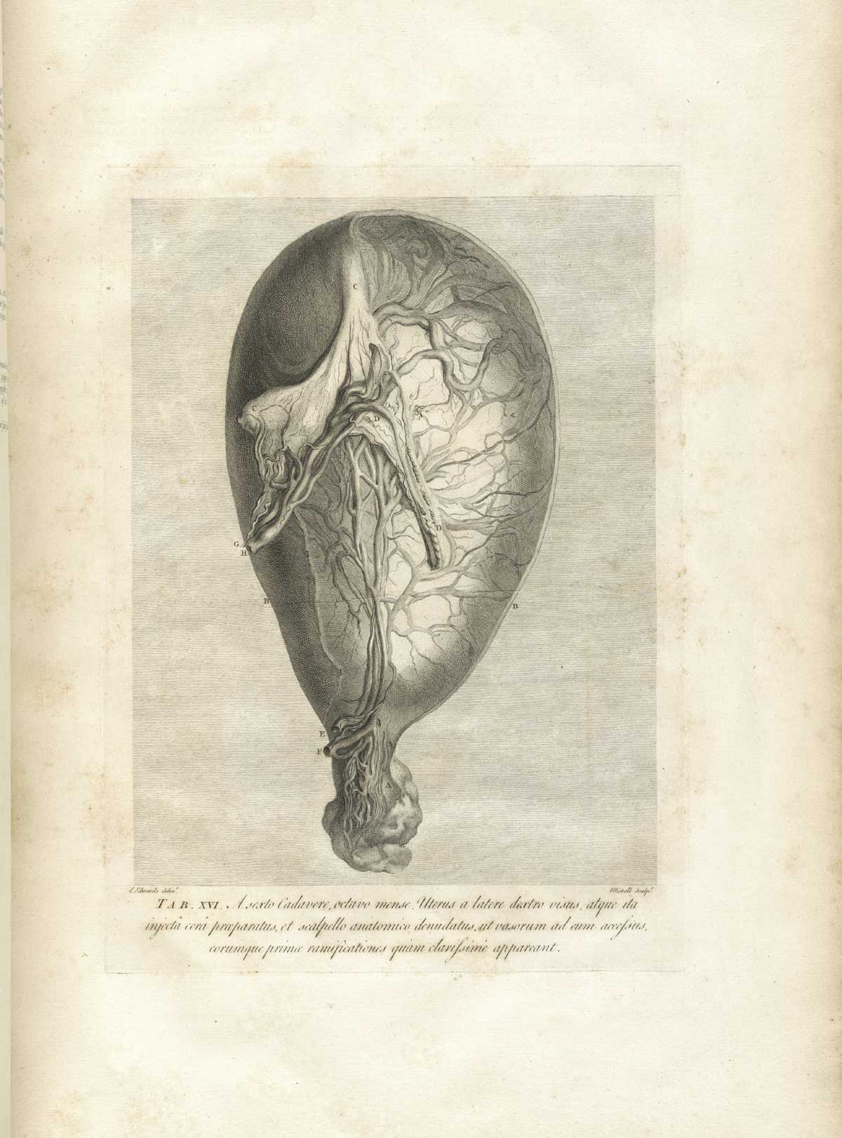 Table 16 of William Hunter's Anatomia uteri humani gravidi tabulis illustrata, featuring a detached gravid uterus.