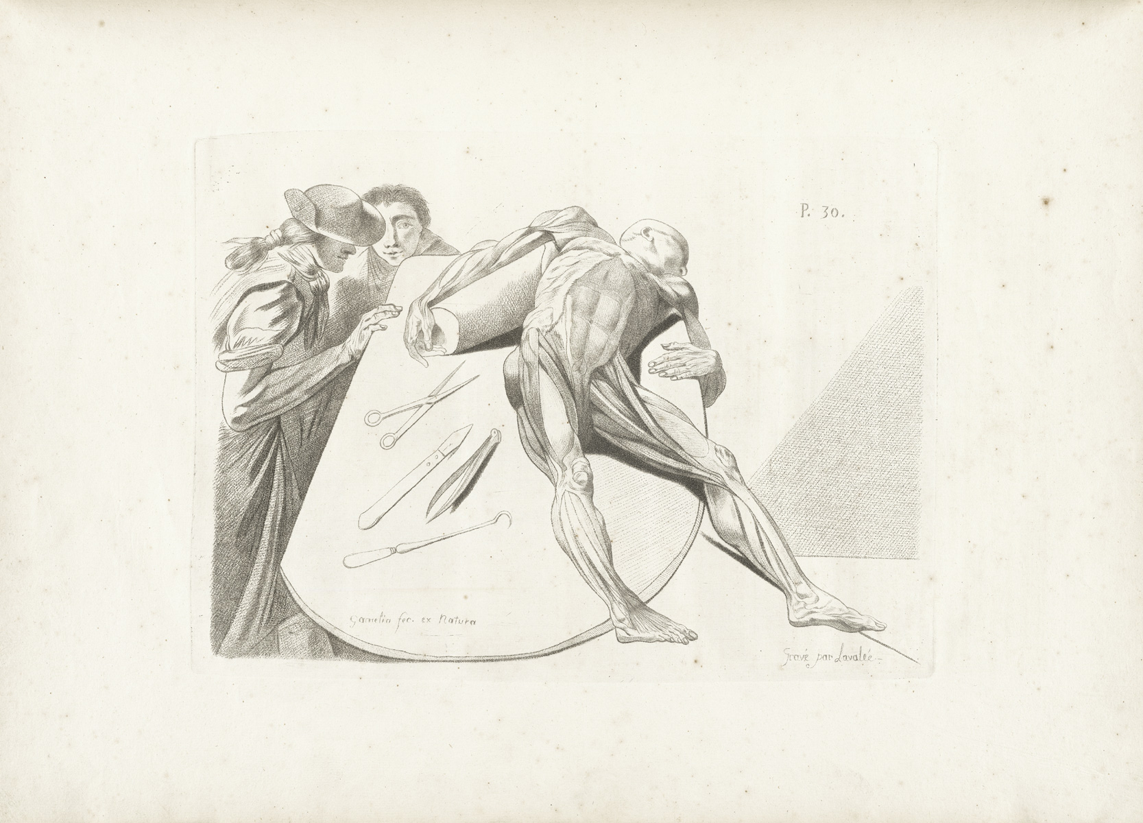 An engraving of a muscle figure lying on a round dissecting table