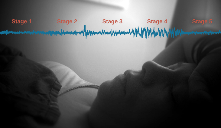 A photograph shows a person sleeping. Superimposed across the top of the picture is a line representing brainwave activity across the five stages of sleep. Above the line, from left to right, it reads stage 1, stage 2, stage 3, stage 4, and stage 5. The wave amplitude is highest in late stage 2, and near the end of stage 3 through stage 4. The wavelength I longer from late stage 2 through stage 4.