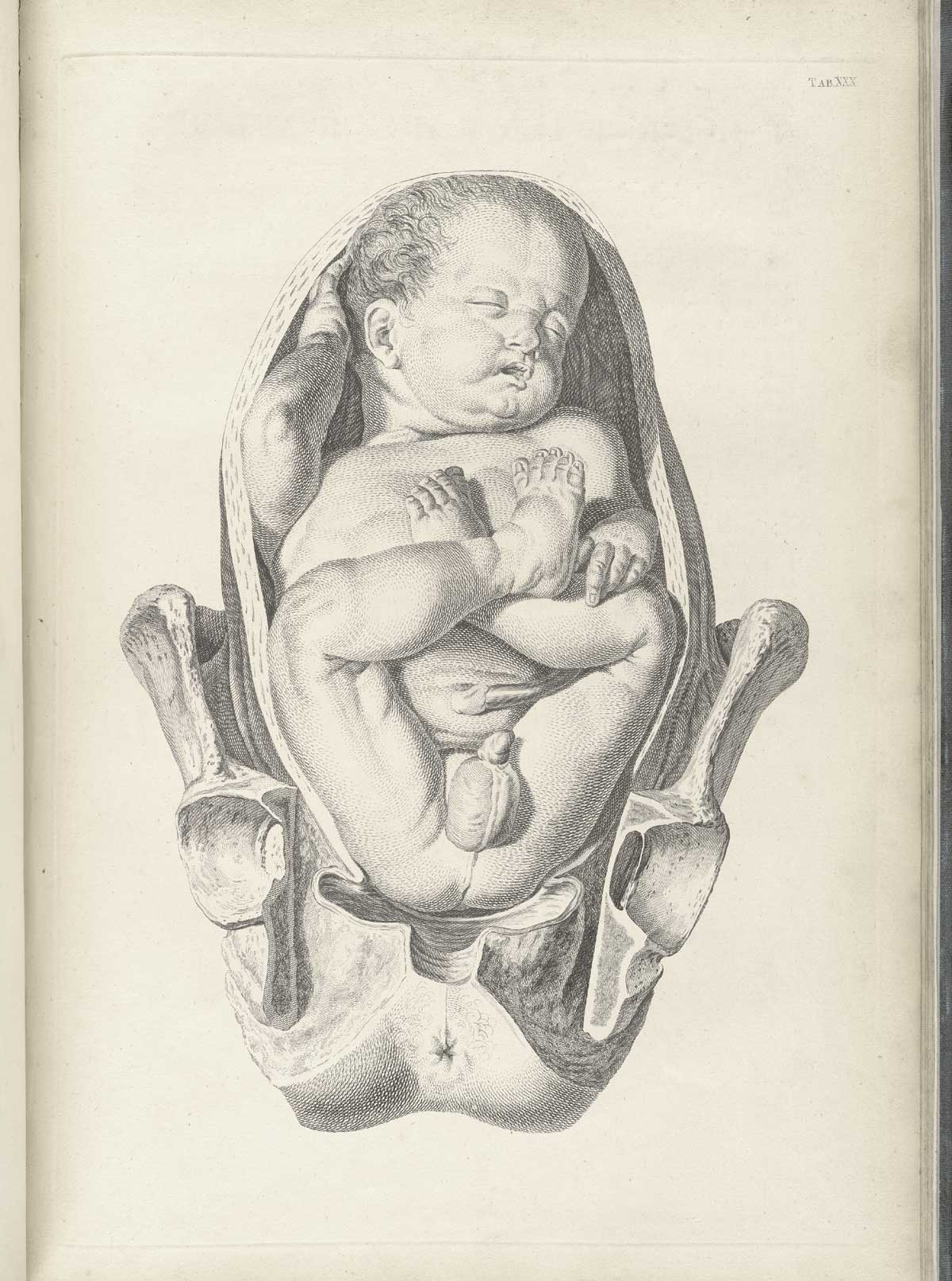 Table 30 of William Smellie's A sett of anatomical tables, with explanations, and an abridgment, of the practice of midwifery, featuring the illustrated drawing of a male fetus in breech position in the uterus.