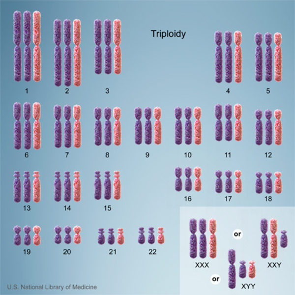 A karyotype with one extra copy of each chromosome, for a total of 69 chromosomes instead of the usual 46.