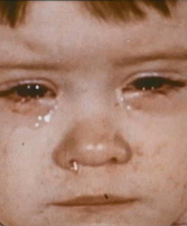 A young child with a runny nose and teary eyes